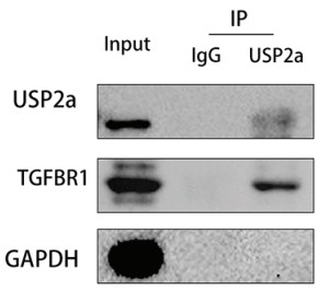 co-IP assays of the interaction between USP2a and TGFBR1.jpg